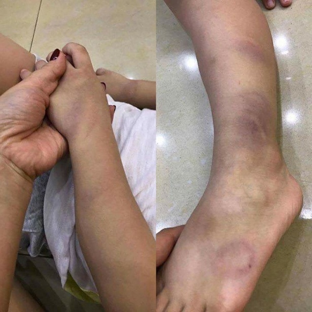 co giao danh hoc sinh bam tay anh 1