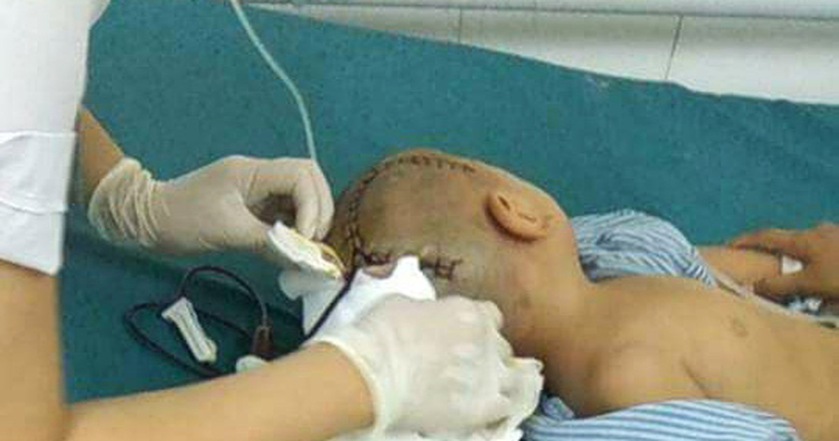 Be 3 tuoi bi chan thuong so nao o truong mam non hinh anh