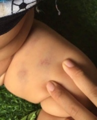 tre bi can khap mat anh 4