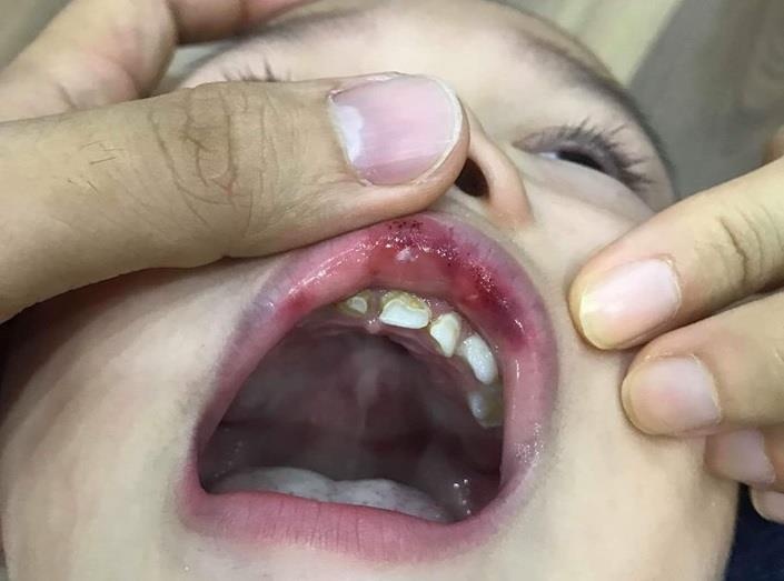 cô giáo tát trẻ ảnh 1 co giao tat tre anh 1