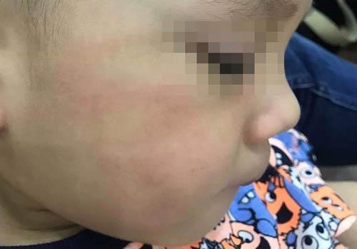 Duoi viec co giao tat tre 3 tuoi bam tim mat, tu mau moi hinh anh