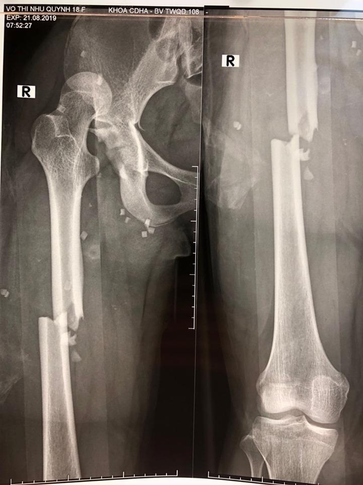 Nhập học tại bệnh viện ảnh 1 Nhap hoc tai benh vien anh 1