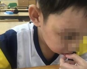 Lam ro nghi van me ke bao hanh be trai 10 tuoi hinh anh