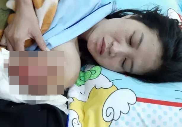 cô giáo bị tai nạn ảnh 1 co giao bi tai nan anh 1