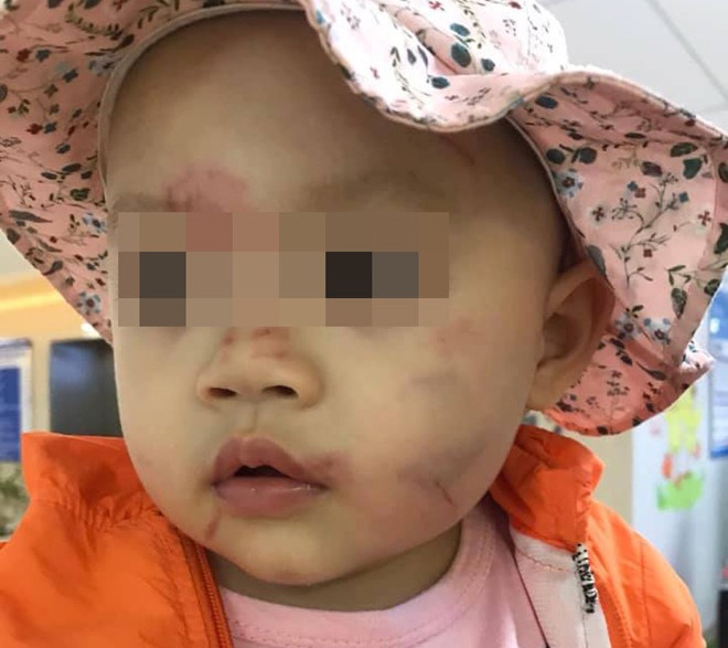 hoc sinh danh nhau anh 5