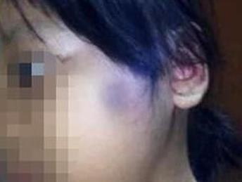 'Cham thuoc la vao be gai 6 tuoi, cha duong qua tan nhan' hinh anh