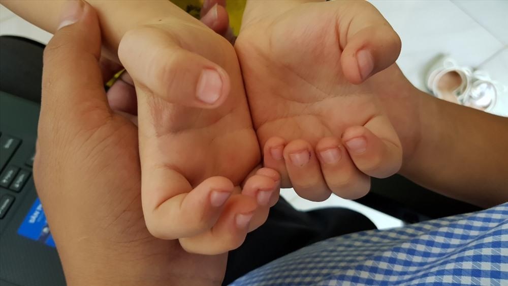 Vu co giao bi to dam vat nhon vao tay tre: Dinh chi co so mam non hinh anh