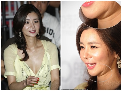 My nhan 'Su quyen ru cua nguoi vo' lo cam lom bat thuong hinh anh