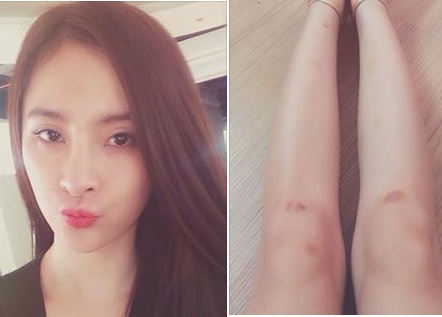 My nhan Viet mat diem khi lo chan day gam hoa xau xi hinh anh