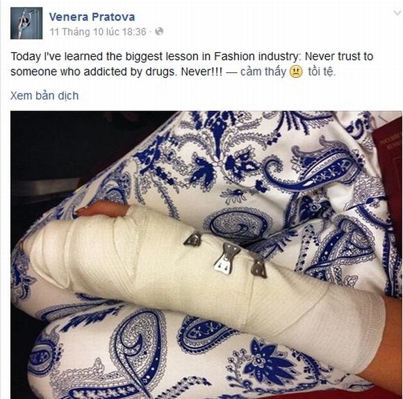 Ảnh chụp cánh tay bị thương của Venera Pratova