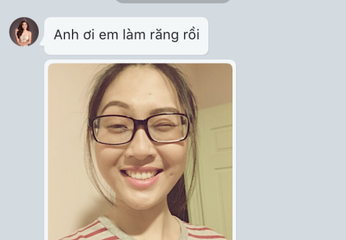 Diệu Ngọc bị tố phẫu thuật thẩm mỹ ảnh 2 Dieu Ngoc bi to phau thuat tham my anh 2