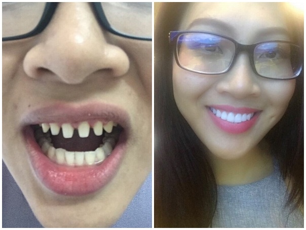 Diệu Ngọc bị tố phẫu thuật thẩm mỹ ảnh 3 Dieu Ngoc bi to phau thuat tham my anh 3