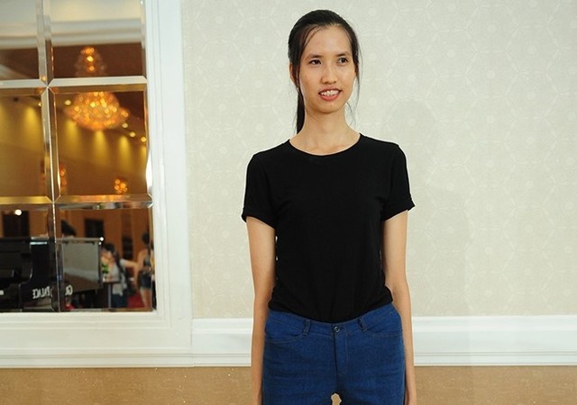 Hồng Xuân phẫu thuật thẩm mỹ ảnh 1 Hong Xuan phau thuat tham my anh 1