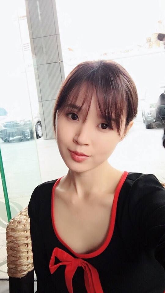 Midu chua tung phau thuat tham my anh 1