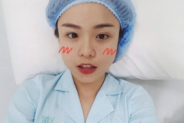 Thai Trinh thua nhan sua mui, cat mi de cai thien nhan sac hinh anh