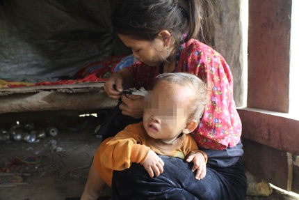 Noi dau hon nhan can huyet thong cua toc nguoi thieu so hinh anh