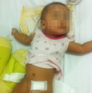 Be gai 6 thang tuoi da phai cat bo buong trung hinh anh