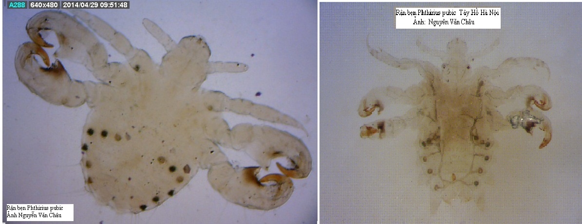 Đặc điểm loại rận thích mùi amoniac nên hay cư trú ở khu vực mu, bẹn người