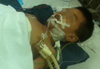 Nga tu lan can, be trai 6 tuoi vo la lach hinh anh