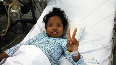 Be 10 tuoi bi ong dot gan 90 vet hinh anh