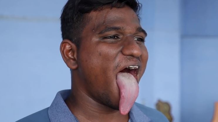 Chang trai An Do co luoi dai den 10,8 cm hinh anh