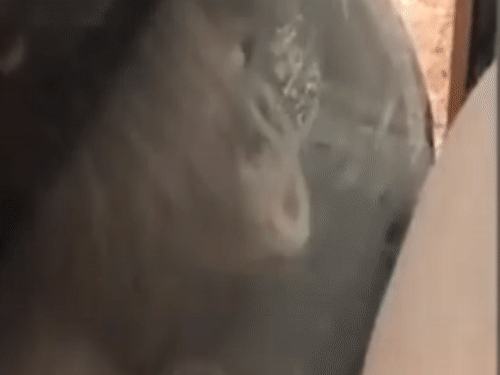 Duoi uoi hon bung bau cua nguoi phu nu qua kinh hinh anh