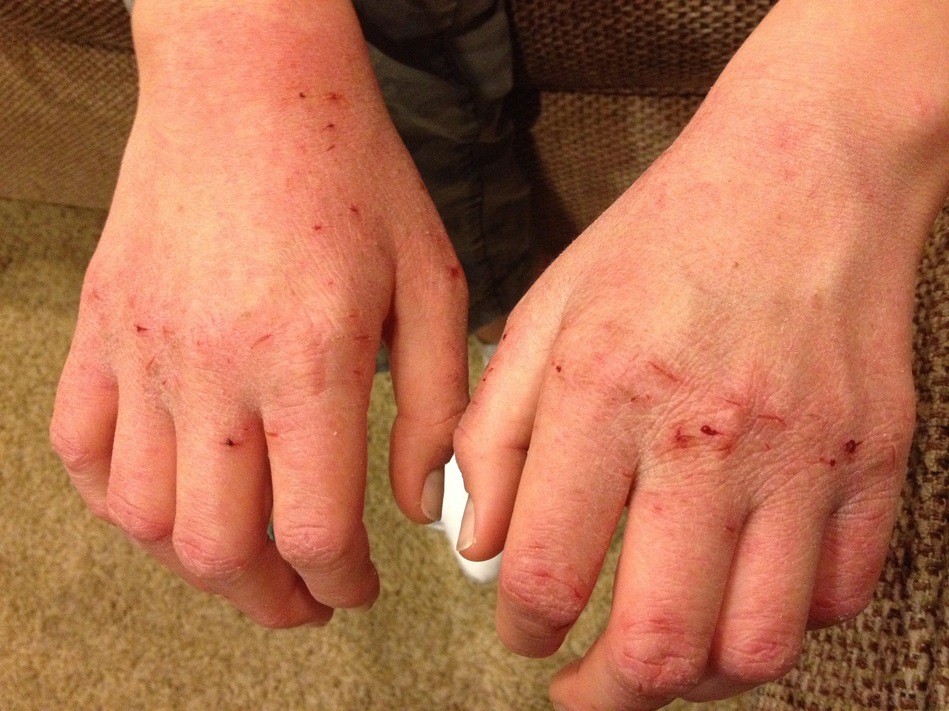 tranh khung hoang tinh than mua dich anh 3