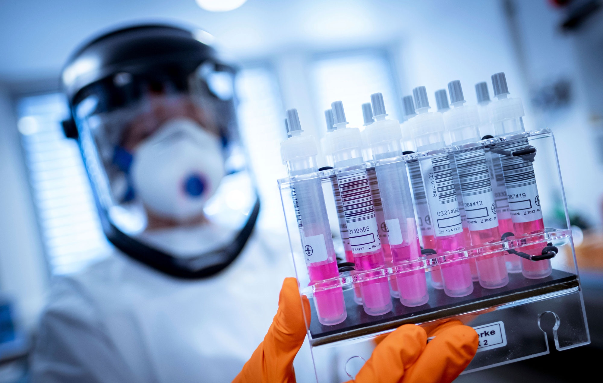 Covid-19 chua phai dai dich cuoi cung cua nhan loai anh 1