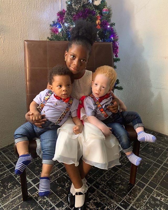 cap song sinh khac mau da anh 5