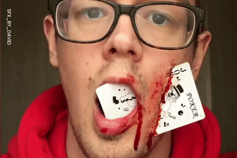 Nguoi dan ong dam me hoa trang rach mat, thung chan, cat dau hinh anh