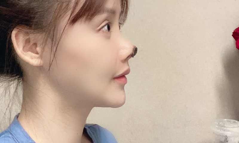 nu dien vien phau thuat mui hong anh 1