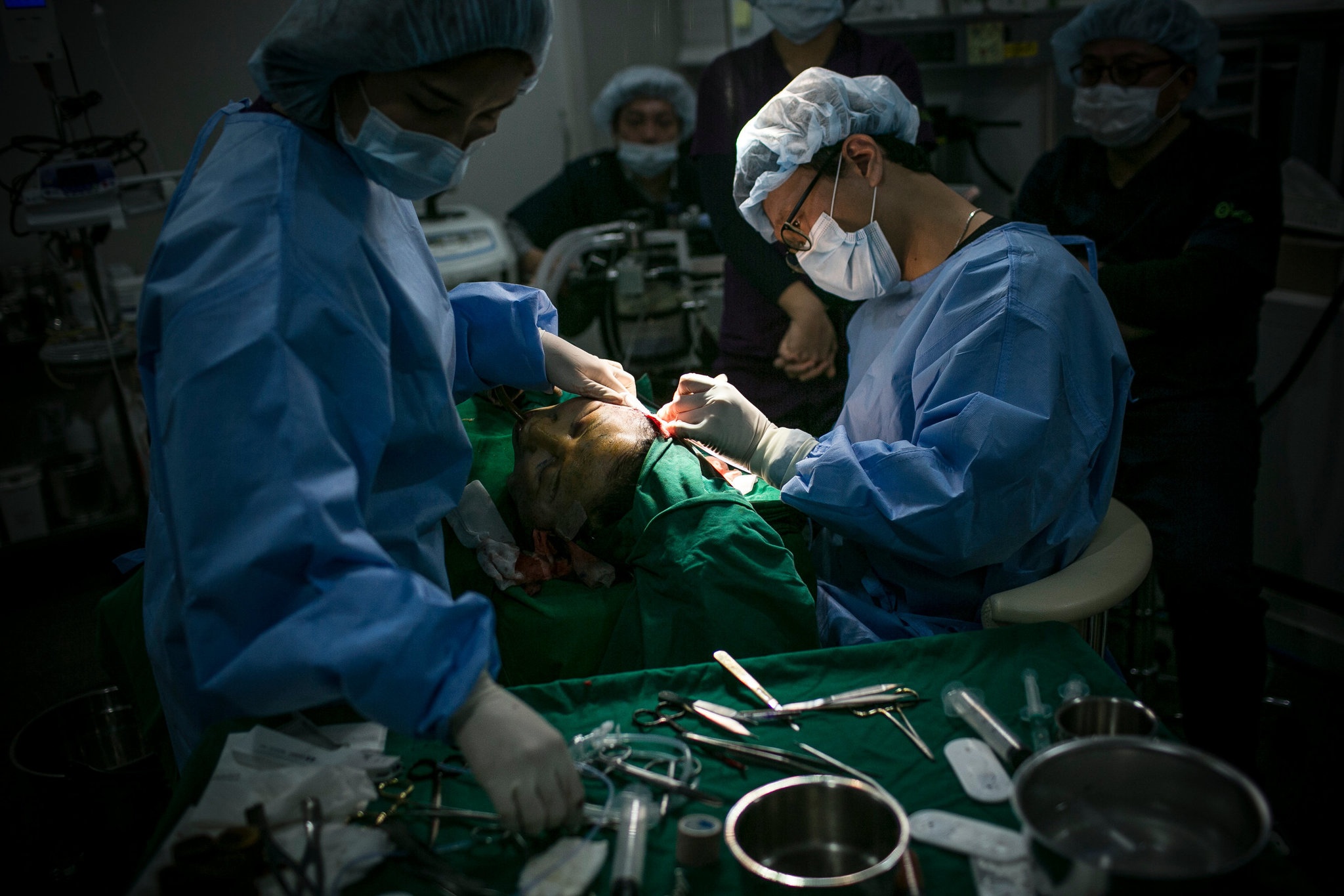 con sot phau thuat tham my o Trung Quoc anh 4