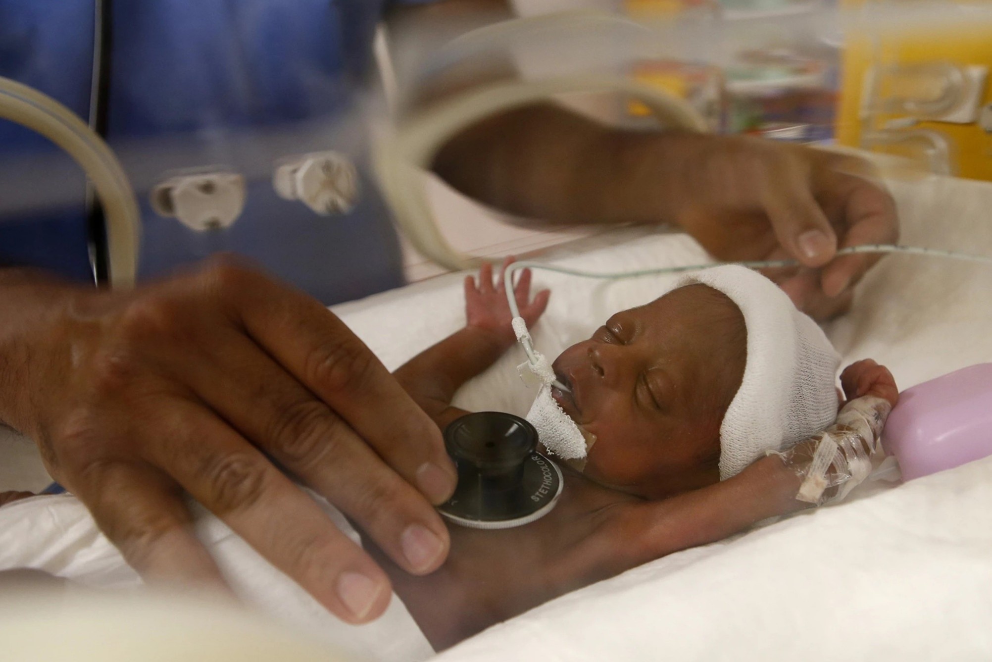 35 nguoi do de cho ca sinh 9 hiem co tren the gioi hinh anh