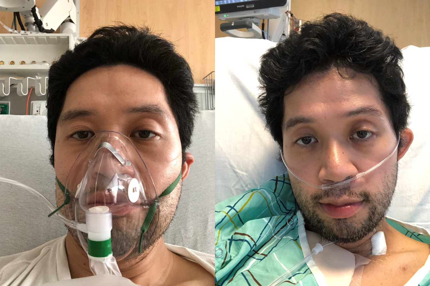 Benh nhan Covid-19 dau tien duoc dat may tho o My hinh anh