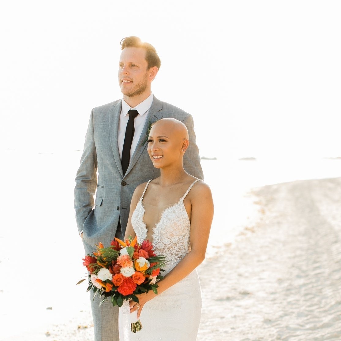 co dau khoe dau troc trong dam cuoi anh 1