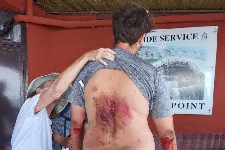 Du khach My roi vao mieng nui lua vi chup anh selfie hinh anh