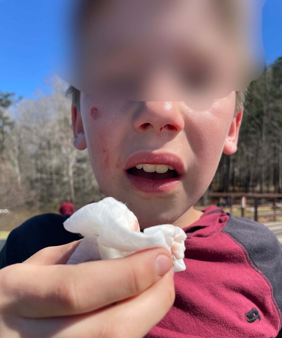 thử thách TikTok ảnh 2 thu thach TikTok anh 2