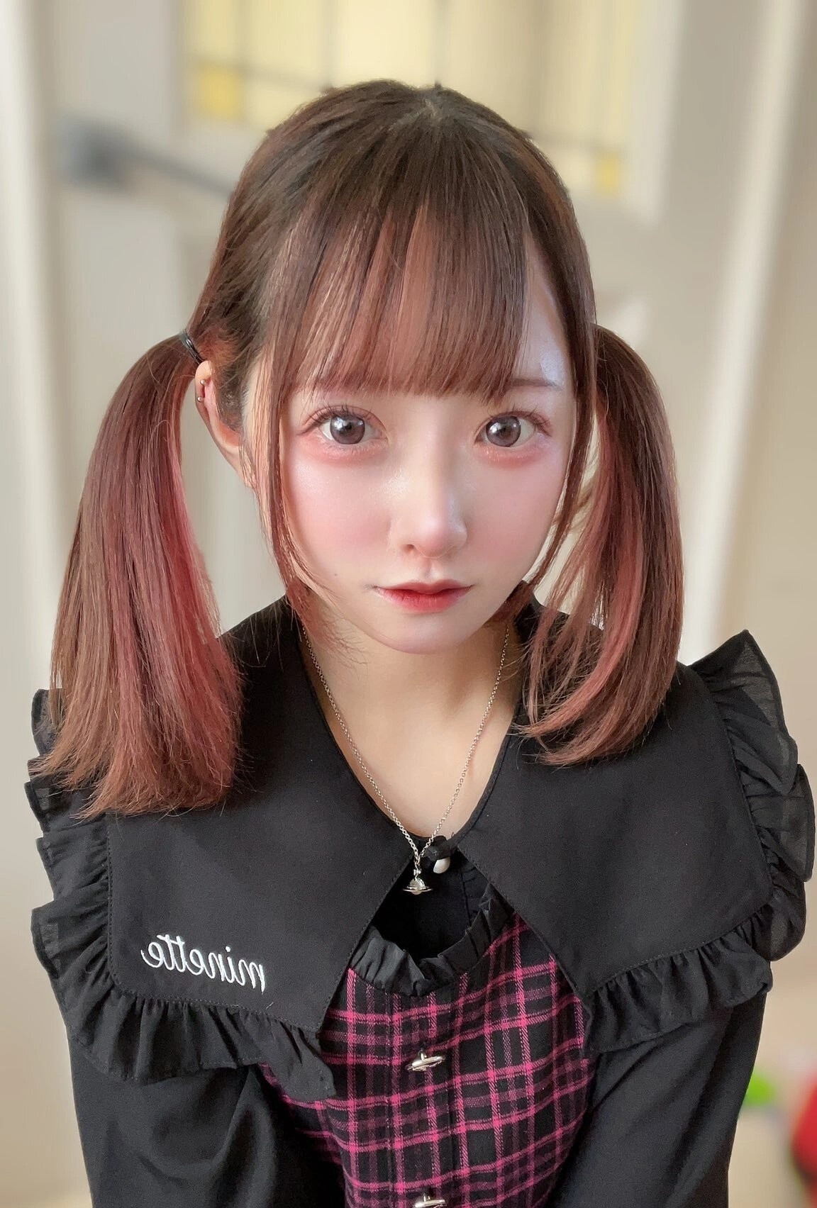 phẫu thuật thẩm mỹ ảnh 2 phau thuat tham my anh 2