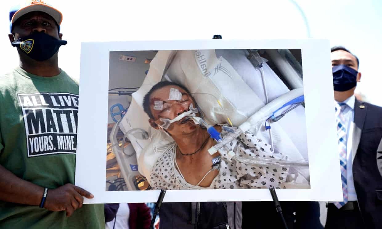 Nguoi dan ong goc A bi danh tu vong o My hinh anh