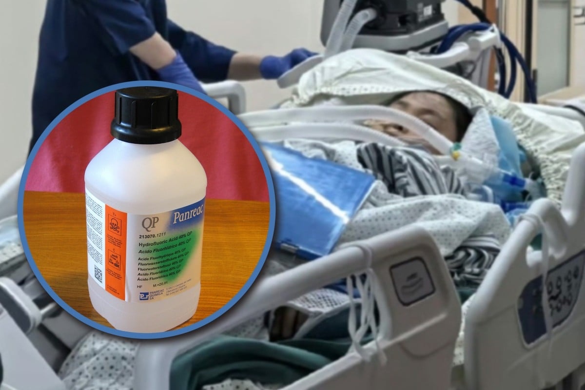 Cai chet cua nguoi phu nu giam phai 'nuoc tan xuong' gay rung dong TQ hinh anh