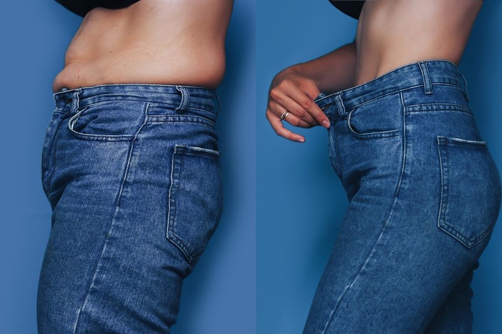 Co gai Gen Z giam 15 cm vong eo nho 'nan' xuong hinh anh