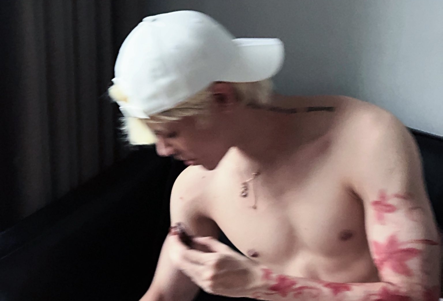 TikToker trieu fan cau cuu vi di ung nghiem trong voi mieng dan xam hinh anh