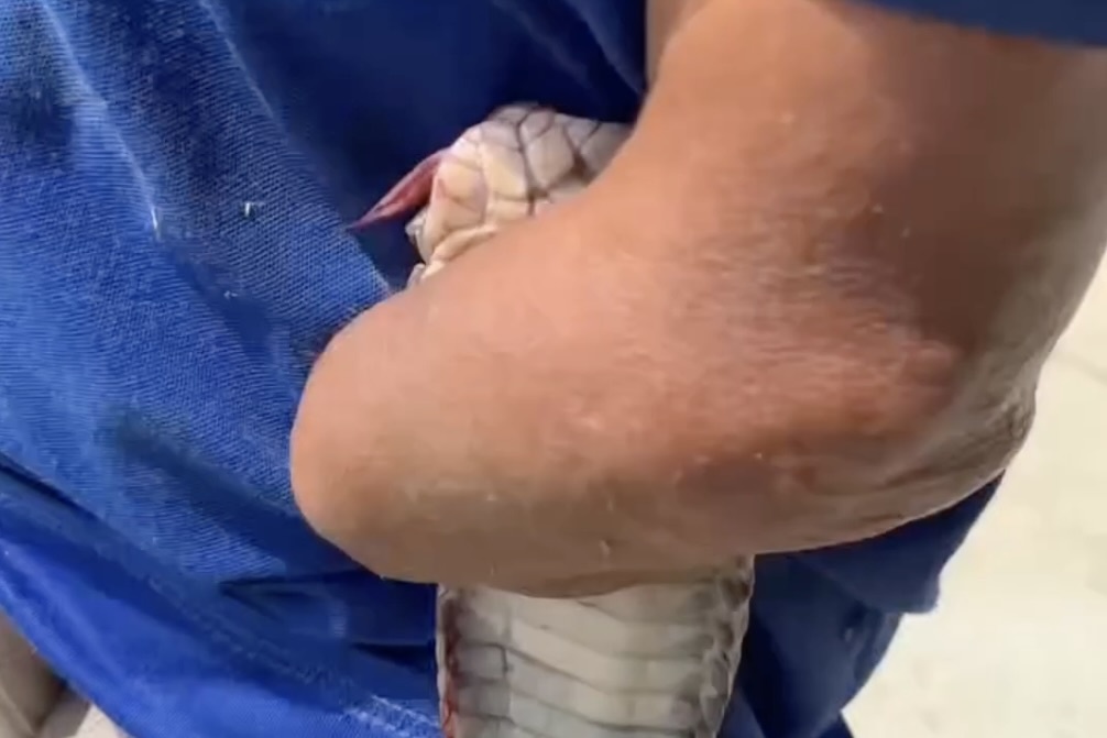 Nguoi dan ong keo ran ho mang den tram y te hinh anh