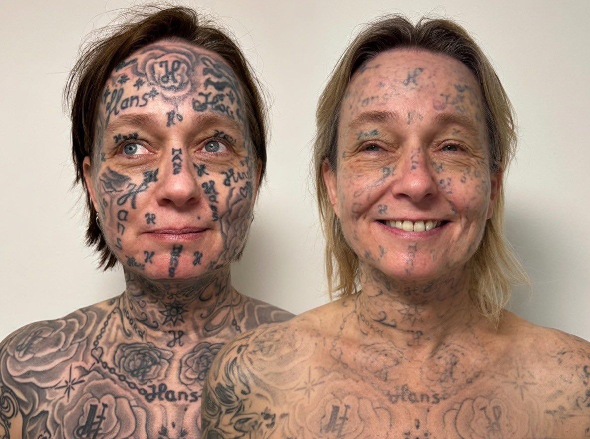 Nguoi phu nu bi ban trai cu ep xam 250 hinh tren khap co the hinh anh