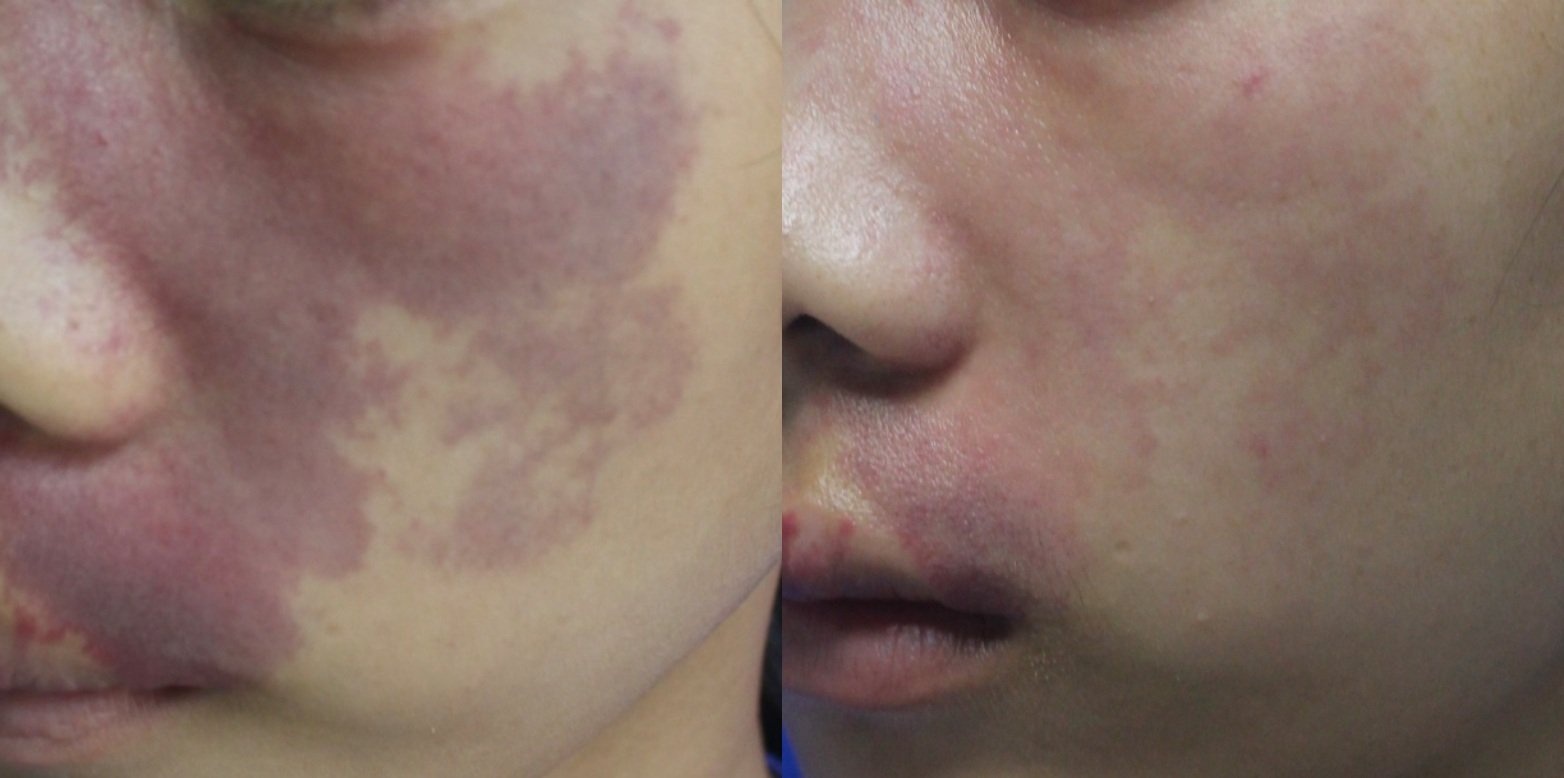 Dap la khong lam mo bot ruou vang anh 1