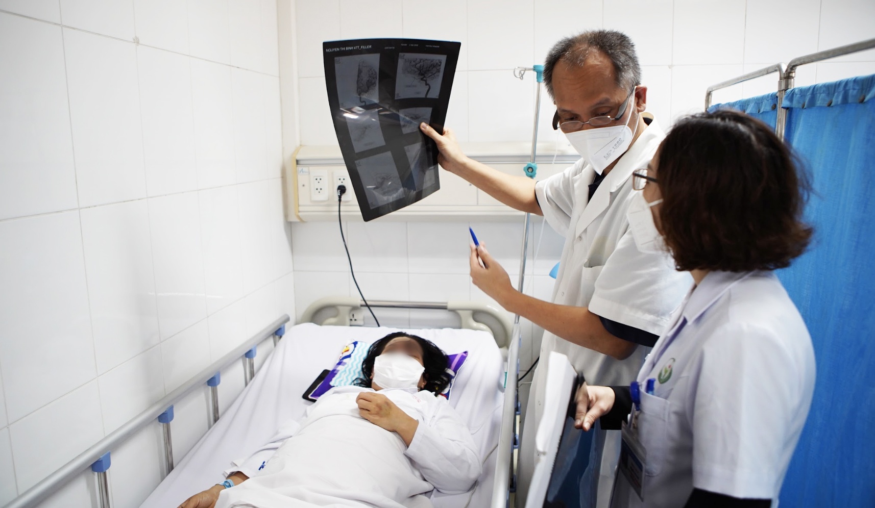 Mu mat sau khi nang mui o spa hinh anh