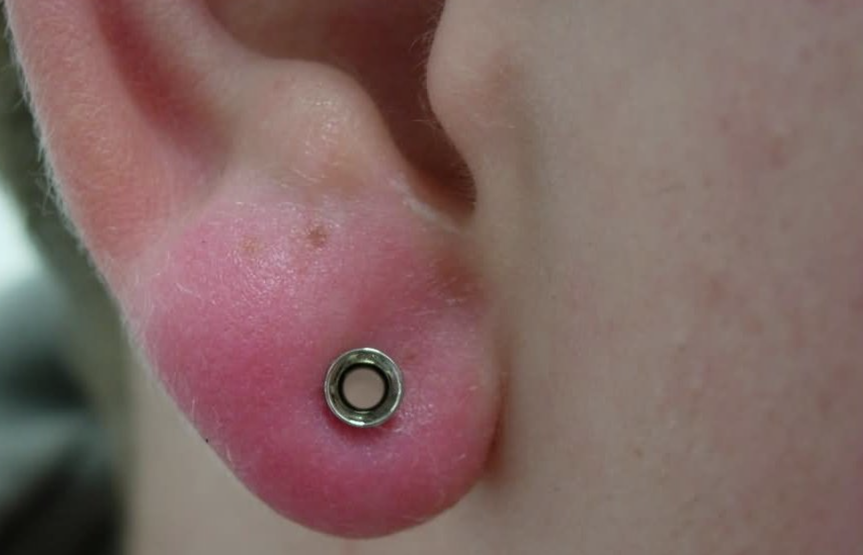 Hiem hoa tu dai tai sung hinh anh