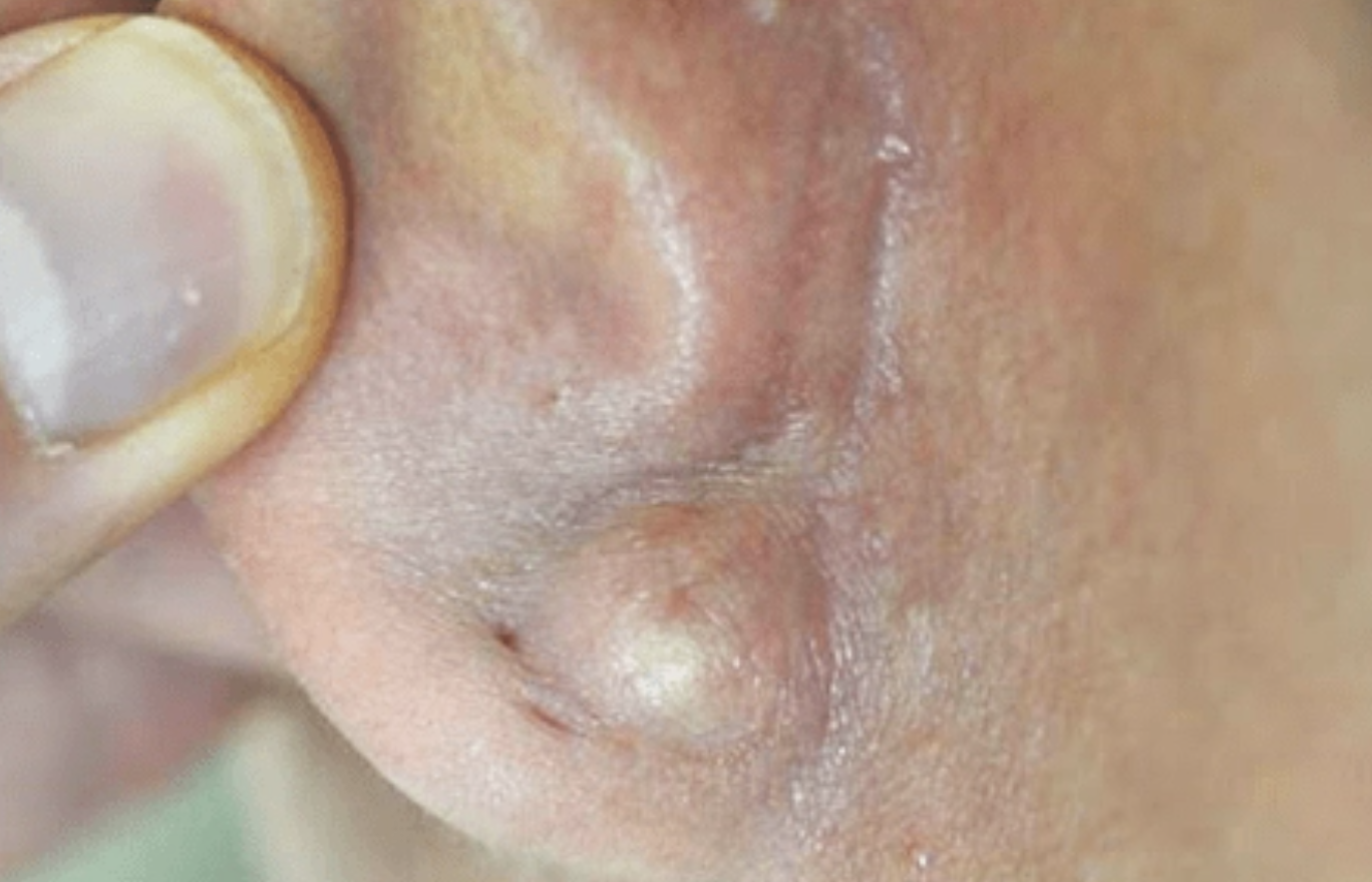 Hiem hoa tu dai tai sung anh 1