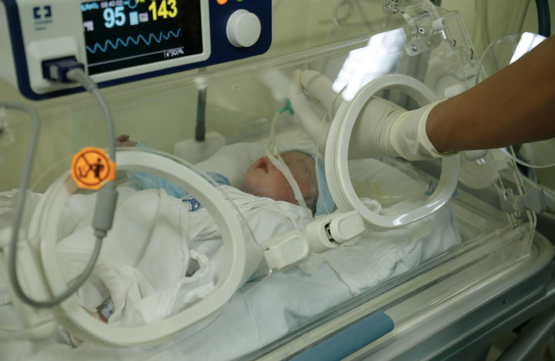 Phat hien ung thu sau khi ra mau bat thuong anh 2