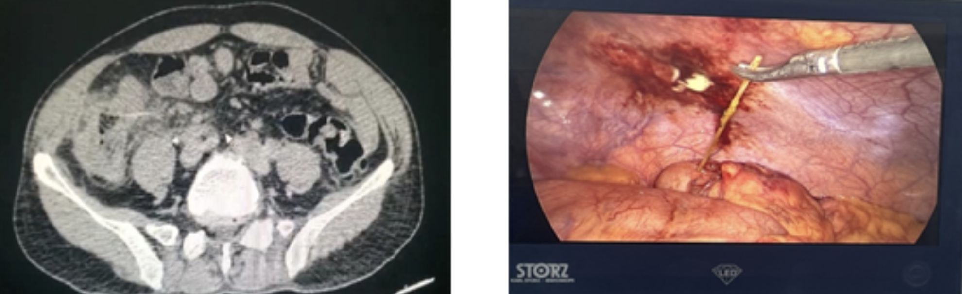 Thung manh trang vi thoi quen ngam tam anh 1